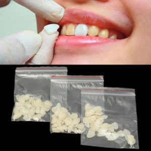 whitening-teeth-upper-anter